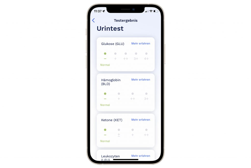 Smartphone zeigt App urintest