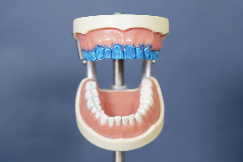 Modell-Gebiss vor blauem Hintergrund mit blauer Paste an Zähnen