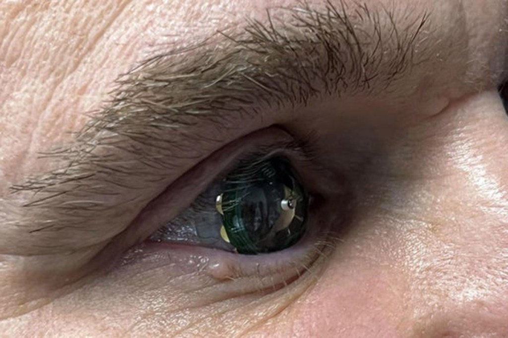 Der CEO von Mojo Vision trägt die Kontaktlinse auf seinem eigenen Auge.