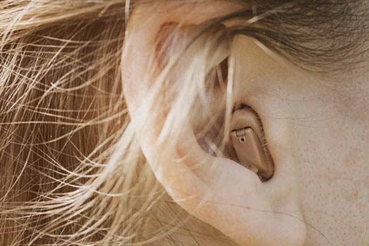 Ein kleines, beiges Hörgerät verschwindet fast im Ohr eines blonden Menschen.