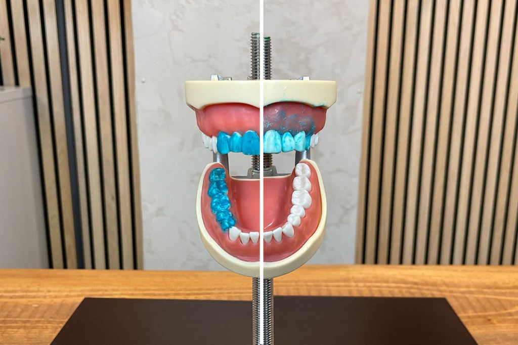 Ein zweigeteiltes Bild: links ist das verschmutze Zahnmodell und rechts das geputzte zu sehen.